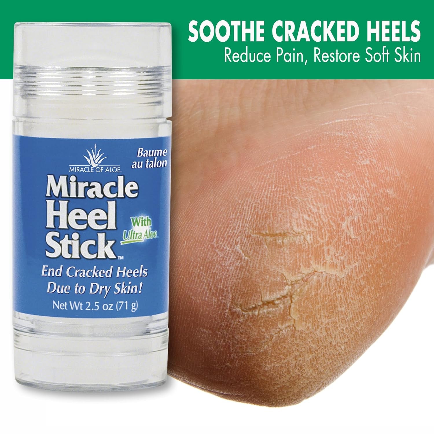 Miracle Heel Stick with Pure Ultraaloe Aloe Vera Gel | 2.5 Ounce Stick