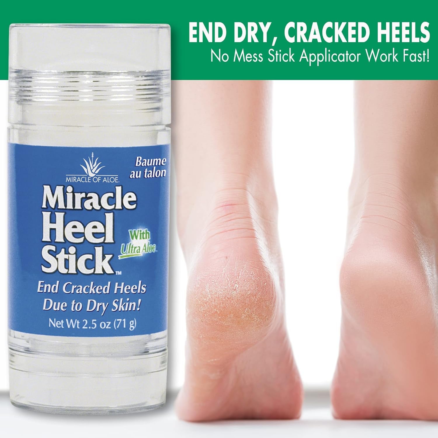 Miracle Heel Stick with Pure Ultraaloe Aloe Vera Gel | 2.5 Ounce Stick